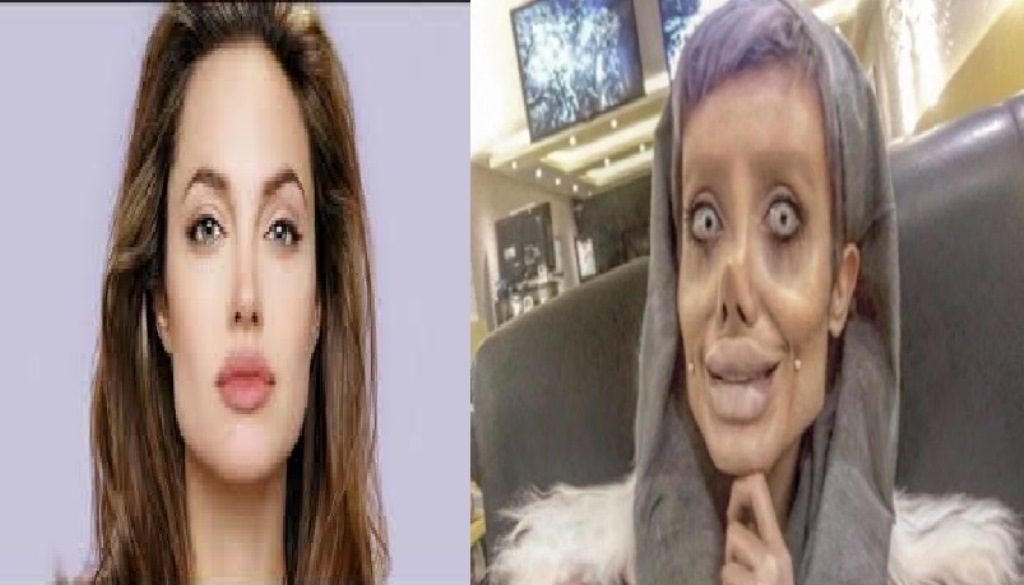 Terobsesi Mirip Angelina Jolie, Wanita ini Lakukan Operasi Sampai 50 Kali, Tapi Hasilnya Malah Begini