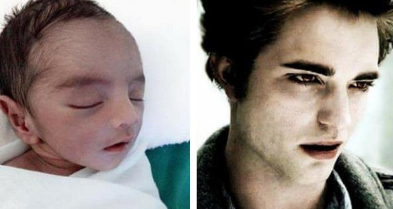 Bayi Ganteng Mirip Robert Pattinson Jadi Viral di Media Sosial