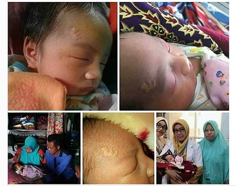 Foto Bayi di Kalimantan ini Mendadak Viral, Ada Lafadz Allah di Dahinya