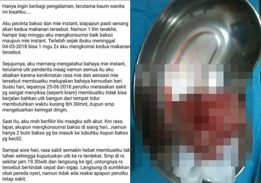 Terlalu Sering Makan Bakso dan Mie Instan, Wanita ini Alami Hal Mengerikan, Kisahnya Viral!