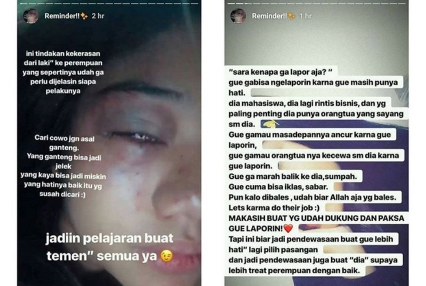 Gak Mau Lapor Polisi Meski Sudah Dianiaya Hingga Nyaris Meninggal, Alasan Cewek ini Bikin Greget Sekaligus Haru