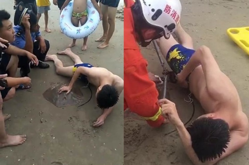 Berenang di Laut, Pemuda ini Alami Hal Mengerikan, 'Masa Depannya' Tertusuk