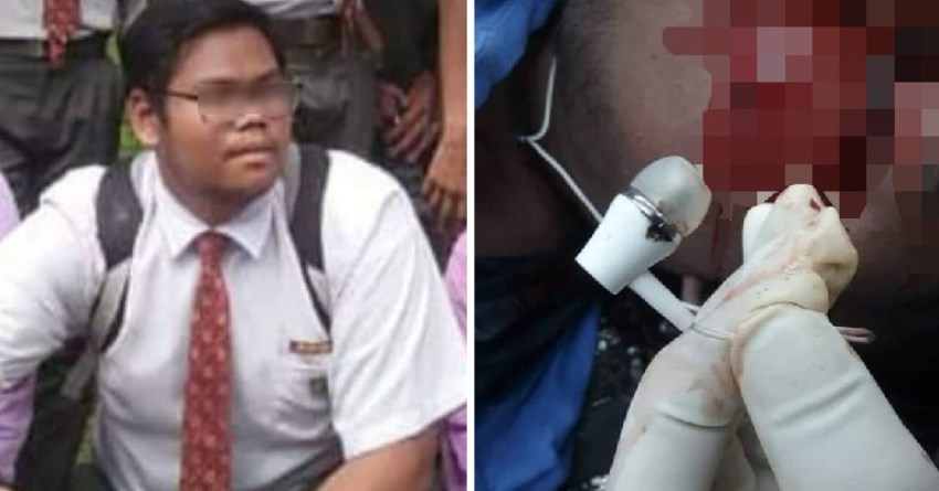 Tidur Pakai Earphone saat HP Dicas, Remaja Pria ini Meninggal Dunia