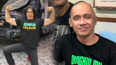 Banyak yang Kaget! Dulu Gagah dan Macho, Kini Artis Ini Mengidap Kanker Otak Stadium 4!