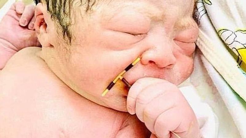 Viral Bayi Lahir Sambil Pegang Alat Kontrasepsi IUD